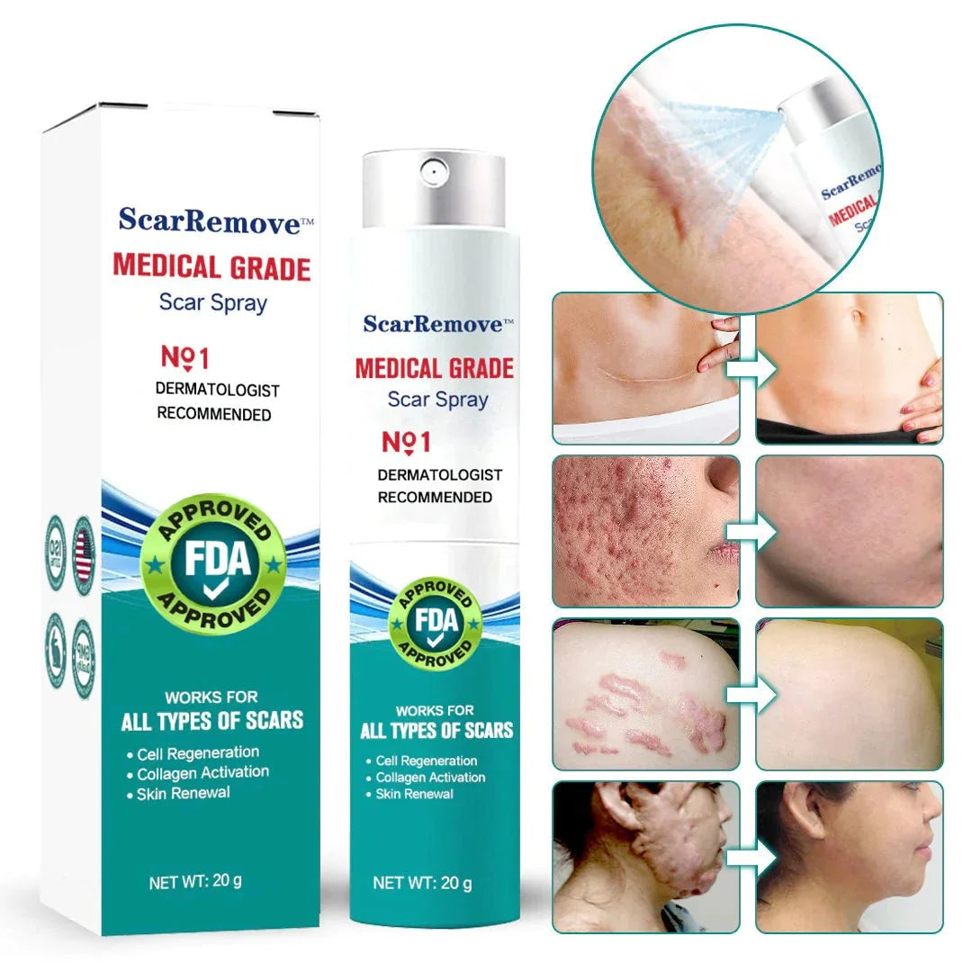 Hot sale 49%off🔥BeautyNue™ Advanced Scar Spray For All Types of Scars - For example Acne Scars, Surgical Scars and Stretch Marks