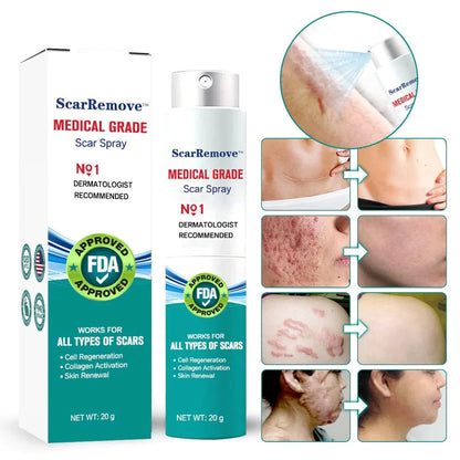Hot sale 49%off🔥BeautyNue™ Advanced Scar Spray For All Types of Scars - For example Acne Scars, Surgical Scars and Stretch Marks