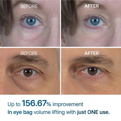 Buy 1 Get 1 Free  49%off🔥Eyebag Cream