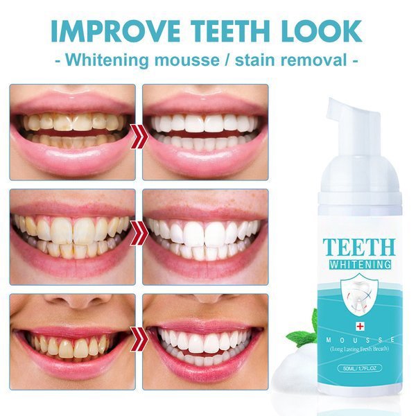 Teeth Mouthwash - Solve allOral Problems