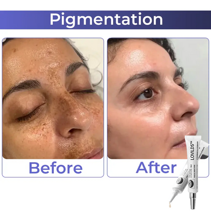 Buy 1 Get 1 Free  49%off🔥Eyebag Cream