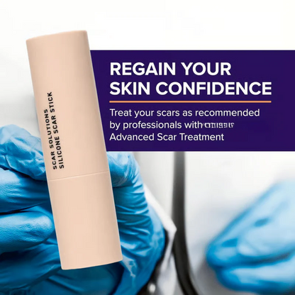 ✨💎 Silicone Scar Stick – Smooth & Renew 💖 Limited Time 49% OFF ⏰