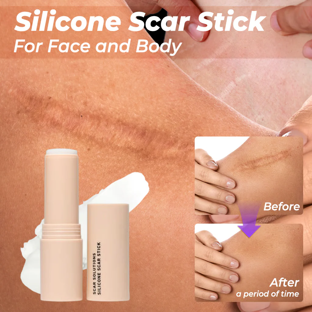 ✨💎 Silicone Scar Stick – Smooth & Renew 💖 Limited Time 49% OFF ⏰