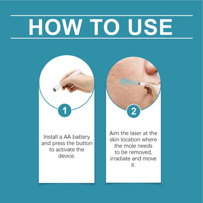 Hot Sale 49% off!🔥Non-Invasive Mole and Wart Removal Laser Pen🔥🔥